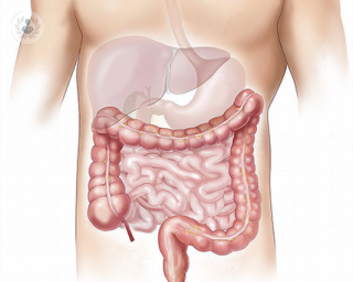 Diagram of the bowel and intestines. 