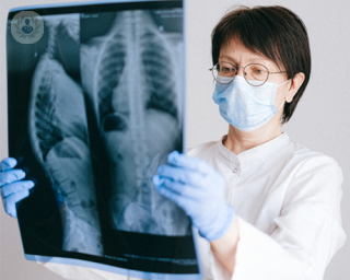 A woman examining an x-ray of the lungs 
