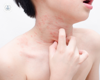 Young boy scratching a rash on his neck