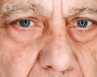 Elderly man with watery eyes