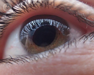 an image of an eye.
