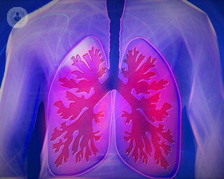 In this article, revered London-based haematologist, Dr Nina Salooja, explains in detail what exactly a pulmonary embolism is. 