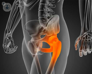 An X-ray image of a hip.