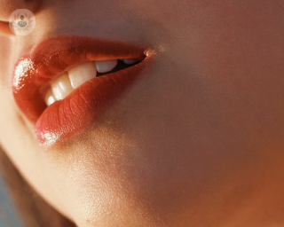 Woman's lips. 
