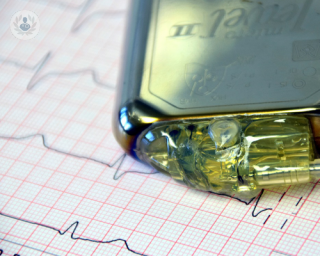 Special pacemaker used in cardiac resynchronisation therapy 
