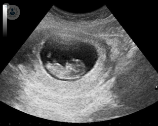 An ultrasound scan of a foetus. 