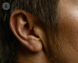 A close-up picture of the ear 