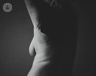 A woman's nude silhouette. Some women following having children or weight loss may choose to have breast lift surgery.