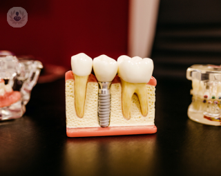 Dental bridges are an extremely effective and popular choice when it comes to replacing missing teeth. 