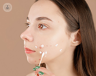 a girl putting cream on her acne