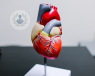 3D medical model of heart