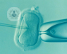 Microscopic picture of IVF process taking place