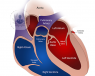 abdominal aortic aneurysm , aaa, heart health, aneurysm, cardiology, aorta