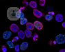 colorectal cancer cells