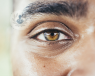 A close up of a man's brown eye. He is looking directly into the camera lens. Lens replacement surgery remove the natural lens and injects an artificial lens.