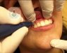 accelerated orthodontics