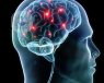 Neurosurgery for brain tumours