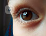 blepharitis-eyes