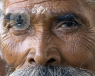 Old man glaucoma