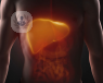 The liver can be affected by a variety of different fatty liver diseases