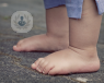Child wearing short blue trousers in bare feet. 