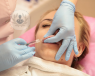 Injection of dermal fillers into face