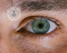 Close up of a man's blue eye with thick eyebrows and a darkened tear trough