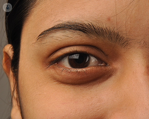 In our latest article, we learn how exactly the eyes can show signs of diabetes, and what can happen if left untreated. 