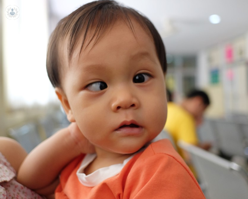 A picture of a child with strabismus (squint)