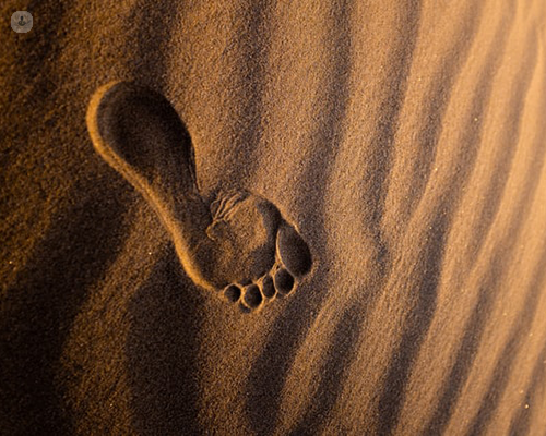 Footprint of someone who has had forefoot reconstruction surgery