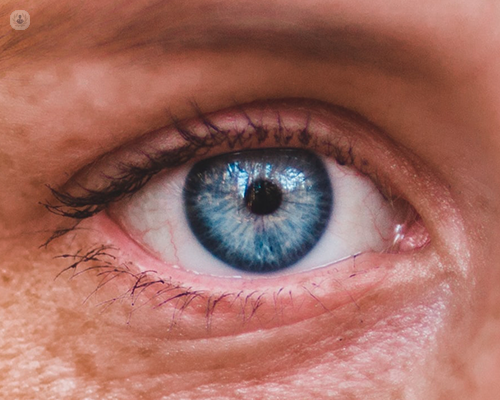 A close up of an eye with a blue iris