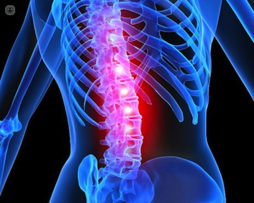 Lumbar spinal stenosis: symptoms, causes, and treatment
