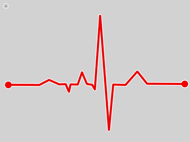 Heart arrhythmias can be diagnosed by an electrophysiology study