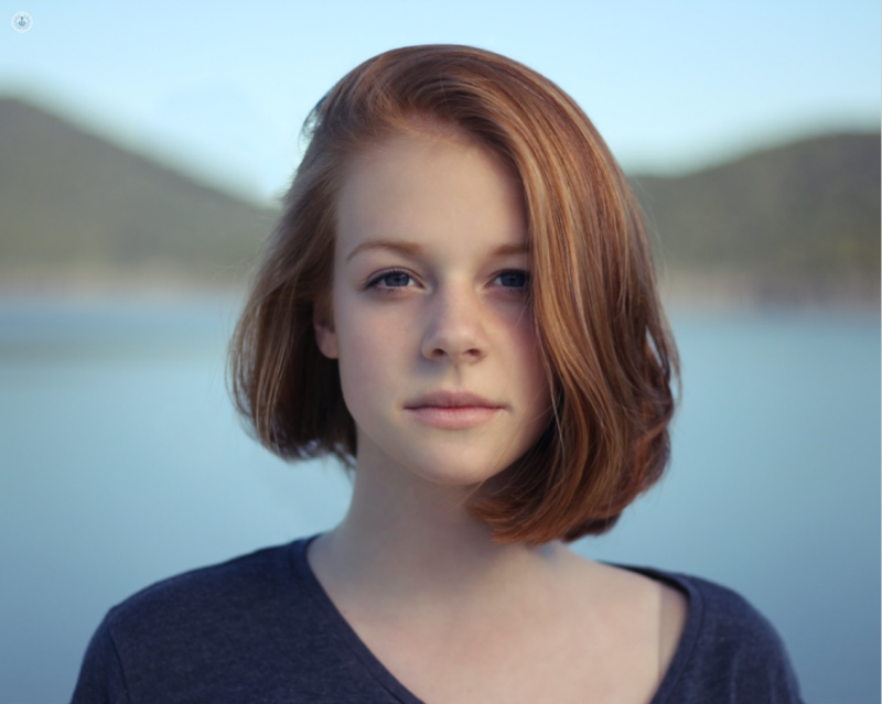 girl with ginger hair rhinoplasty