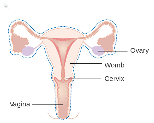 Diagram of female reproductive system that would be operated on in fertility-sparing surgery