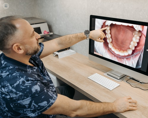 Dentist showing a patient an impacted wisdom tooth