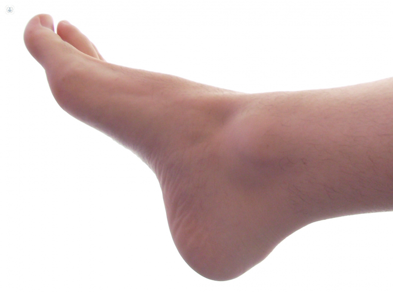 Outside Foot Pain - Symptoms, Causes, Treatment & Rehabilitation
