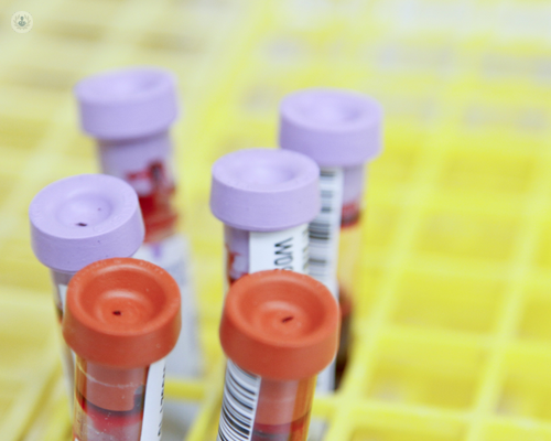 Blood test results for anti heparin platelet factor 4 antibodies