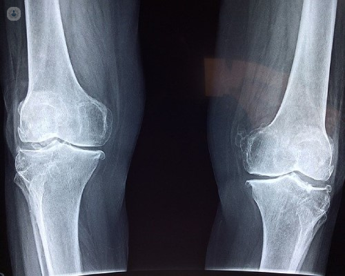 A knee x-ray