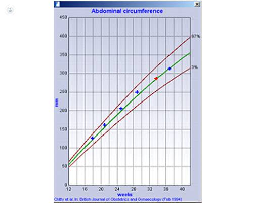 Graph of abdominal circumference at 24 weeks