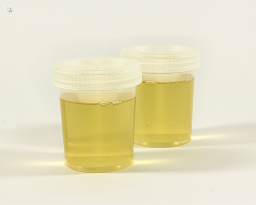 protein in urine
