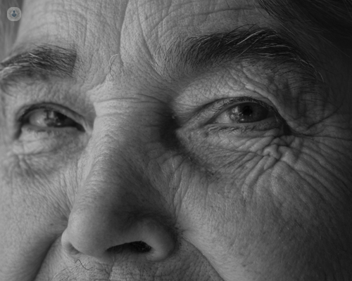 Older woman, who is at risk of developing glaucoma
