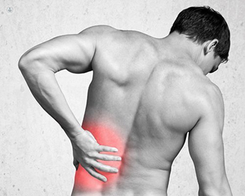Flank Pain: Causes, Symptoms, and Diagnosis