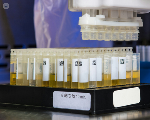 Urine being analysed for Zika virus testing