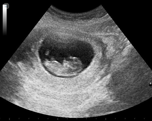 Ultrasound: what is it, and treatment | Top
