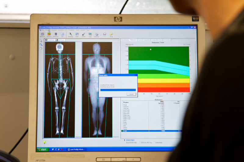 DEXA Scan - Scores & Everything You Need to Know