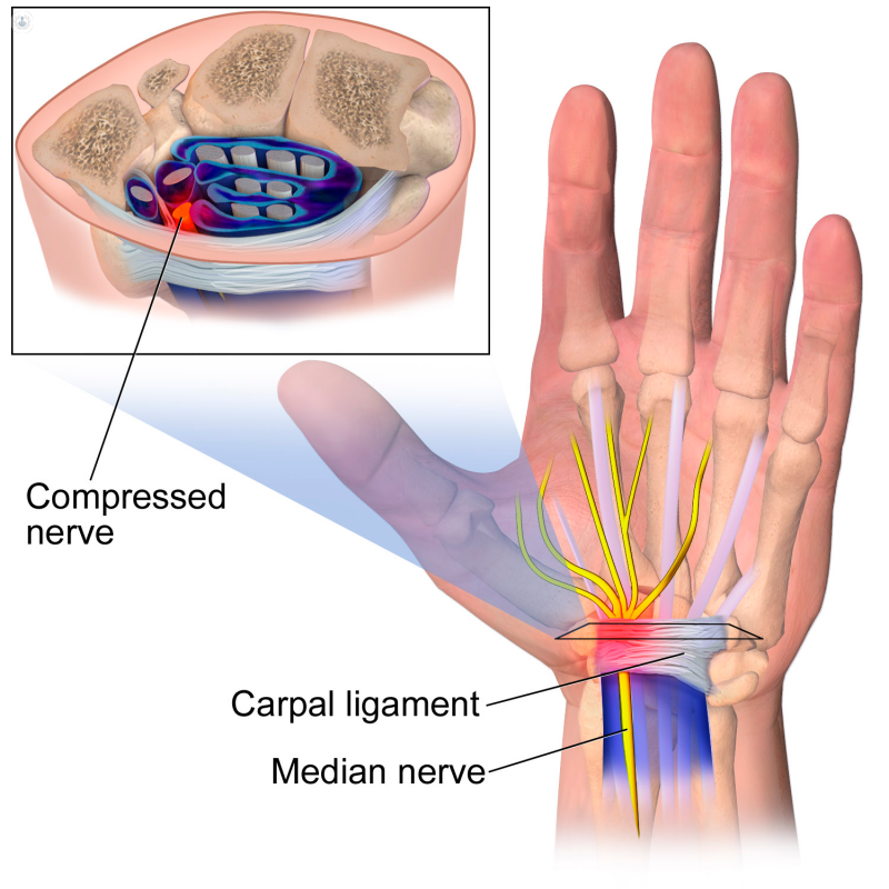 What are the symptoms of a median nerve injury?