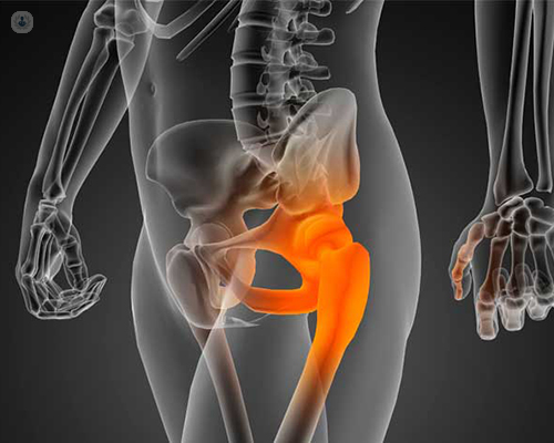 Hip: what is it, symptoms and treatment