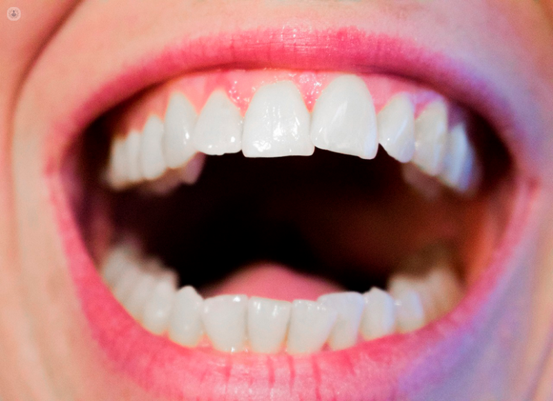 Receding Gums What Is It Symptoms And Treatment Top Doctors