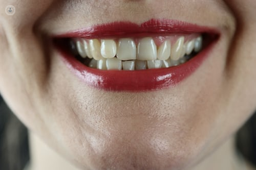 Woman showing her teeth 